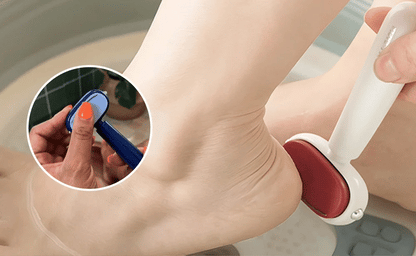 Foot Callus Remover