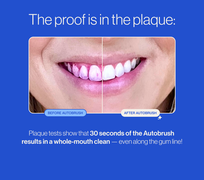 Autobrush® Sonic Pro Bundle