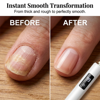 💎 LIMITED-TIME 50% OFF! ✨Professional Electric Nail Polisher